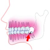 Fig3Fem炸ɂȂ