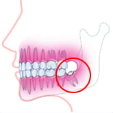 Fig4F