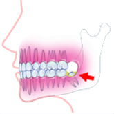 Fig5Fv[N܂₷Ȃ