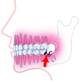 Fig6Fem炸̎OɂȂ