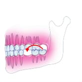 Fig12-2Fem炸ڐA