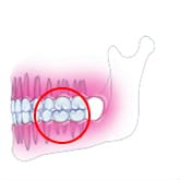 Fig12-3Fem炸ڐA