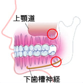 Fig13FƂem炸